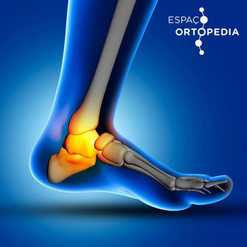 Dicas e Casos - Espaço Ortopedia